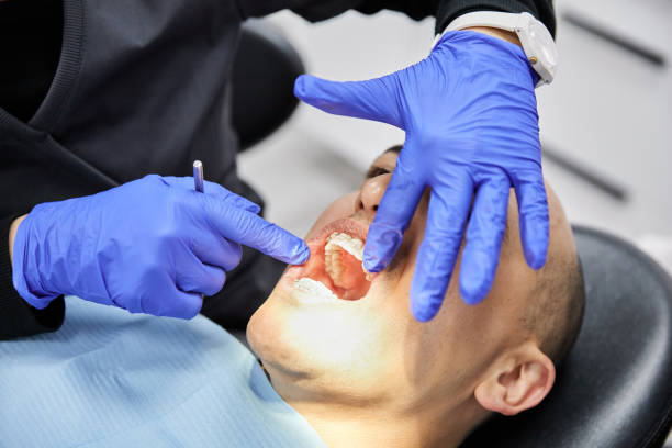 Best Knocked-Out Tooth (Avulsed Tooth) Treatment in Angola On The Lake, NY